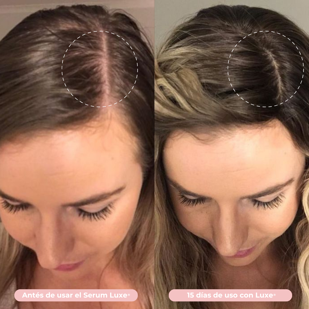Serum de Crecimiento Capilar Luxe® Resultados en 14 días