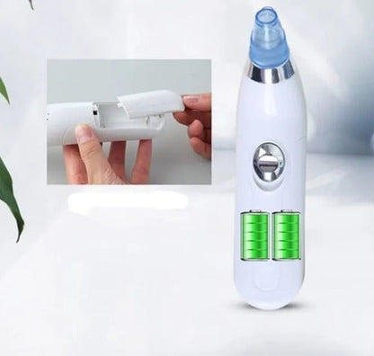 DermaSuction® Limpiador de Poros Profesional
